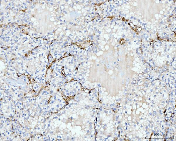 FABP4 Mouse Monoclonal Antibody