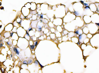 FABP4 Mouse Monoclonal Antibody