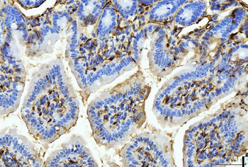 FABP4 Mouse Monoclonal Antibody
