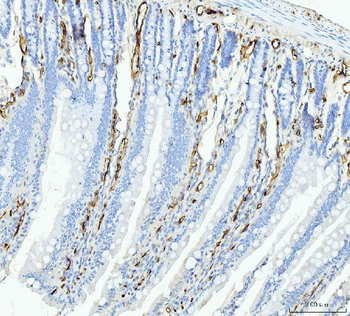 FABP4 Mouse Monoclonal Antibody