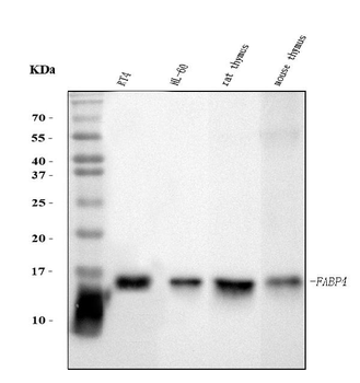 FABP4 Mouse Monoclonal Antibody