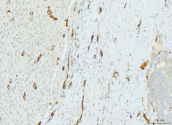 FABP4 Mouse Monoclonal Antibody