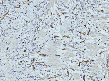 FABP4 Mouse Monoclonal Antibody