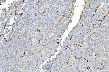 FABP4 Mouse Monoclonal Antibody