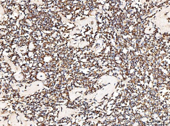 ACADM/MCAD Rabbit Polyclonal Antibody