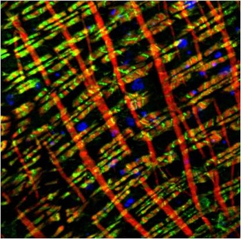 Myosin Heavy Chain Mouse mAb Antibody