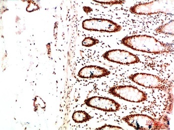HP-1α (5E3) Mouse mAb Antibody