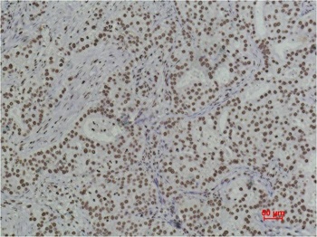 Histone H3 (di methyl K79) Mouse mAb Antibody