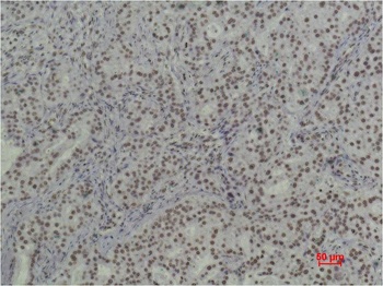 Histone H3 (tri methyl K79) Mouse mAb Antibody