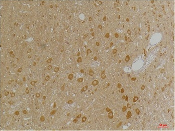 GABA A Receptor α3 Rabbit pAb Antibody