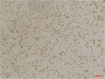 GABA A Receptor α3 Rabbit pAb Antibody