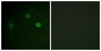 Cdk1/2/3 (phospho Thr14) rabbit pAb Antibody