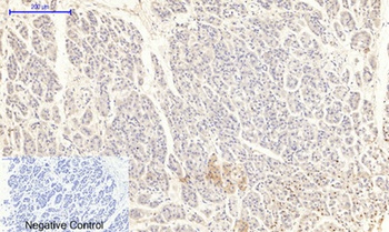 JAK2 (phospho Tyr1007) rabbit pAb Antibody