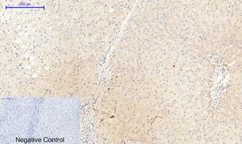 JAK2 (phospho Tyr1007) rabbit pAb Antibody