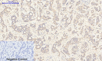 JAK2 (phospho Tyr1007) rabbit pAb Antibody