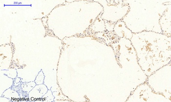JAK2 (phospho Tyr1007) rabbit pAb Antibody