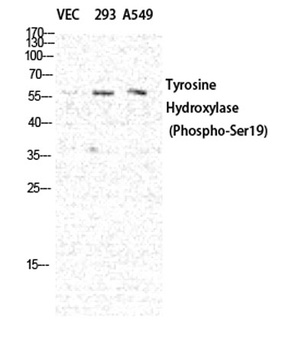 TH (phospho Ser19) rabbit pAb Antibody