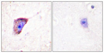 TH (phospho Ser19) rabbit pAb Antibody