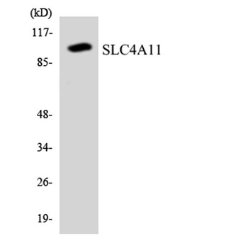 BTR1 rabbit pAb Antibody