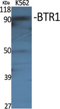 BTR1 rabbit pAb Antibody