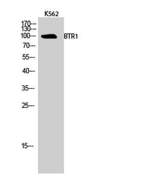 BTR1 rabbit pAb Antibody