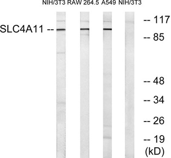 BTR1 rabbit pAb Antibody