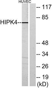 HIPK4 rabbit pAb Antibody