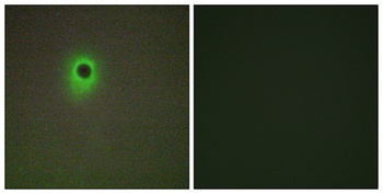 HIPK4 rabbit pAb Antibody