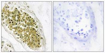 HIPK4 rabbit pAb Antibody