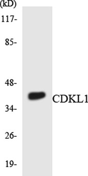 KKIALRE rabbit pAb Antibody