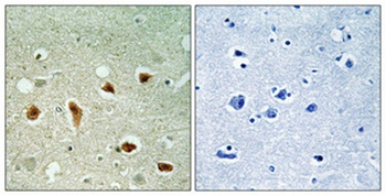 KKIALRE rabbit pAb Antibody
