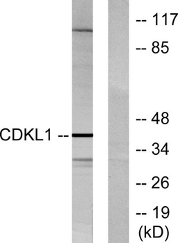 KKIALRE rabbit pAb Antibody