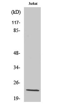 SOCS-2 rabbit pAb Antibody