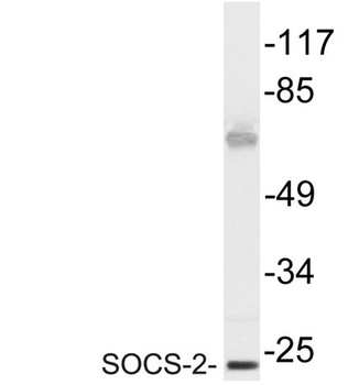 SOCS-2 rabbit pAb Antibody
