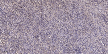 SOCS-2 rabbit pAb Antibody
