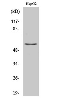 Tyrosine Hydroxylase rabbit pAb Antibody