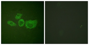 Tyrosine Hydroxylase rabbit pAb Antibody