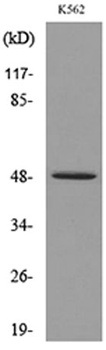 Kallistatin rabbit pAb Antibody