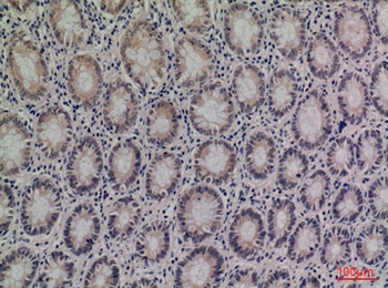Kallistatin rabbit pAb Antibody