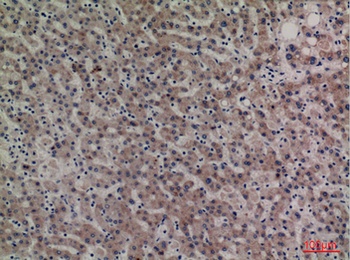 Kallistatin rabbit pAb Antibody