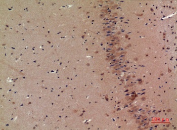 CRF-RI rabbit pAb Antibody