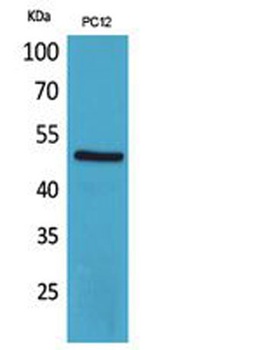 CRF-RI rabbit pAb Antibody