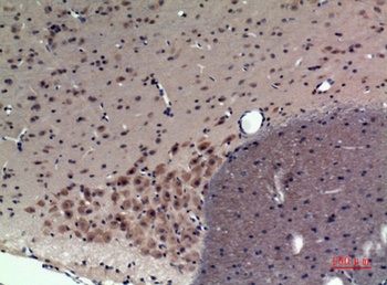 CRF-RI rabbit pAb Antibody