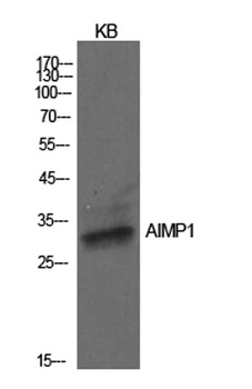 EMAP II rabbit pAb Antibody