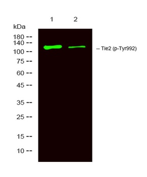 Tie-2 (phospho Tyr992) rabbit pAb Antibody