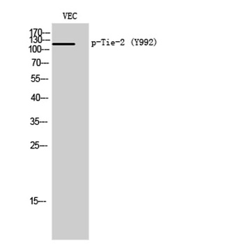 Tie-2 (phospho Tyr992) rabbit pAb Antibody