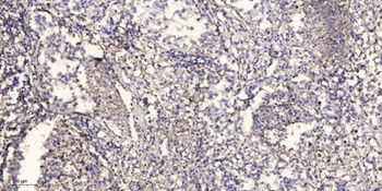 Tie-2 (phospho Tyr992) rabbit pAb Antibody