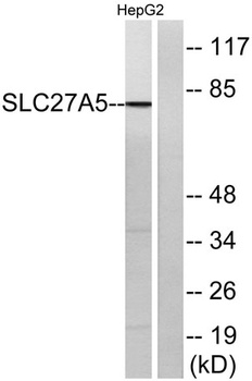 ACSVL6 rabbit pAb Antibody