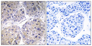ACSVL6 rabbit pAb Antibody