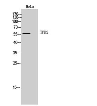 TPH2 rabbit pAb Antibody